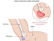 Porada id 7844